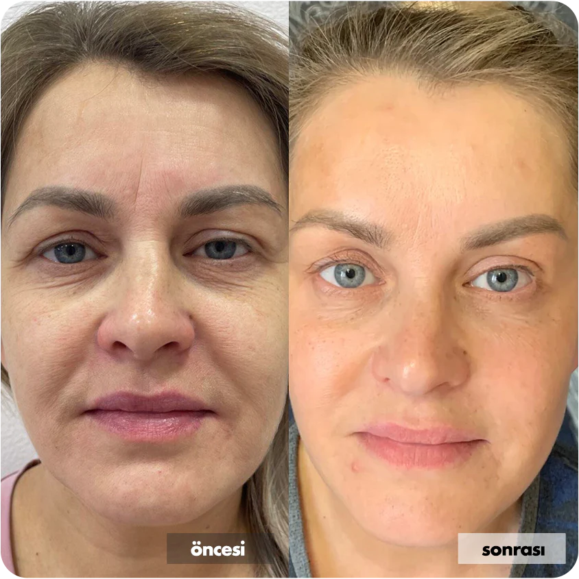 Nemlendirici Yüz Kremi Cilt Tonu Eşitleyici Aydınlatıcı 50 ML