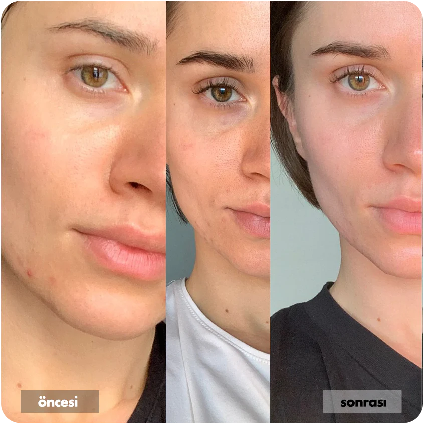 Nemlendirici Yüz Kremi Cilt Tonu Eşitleyici Aydınlatıcı 50 ML