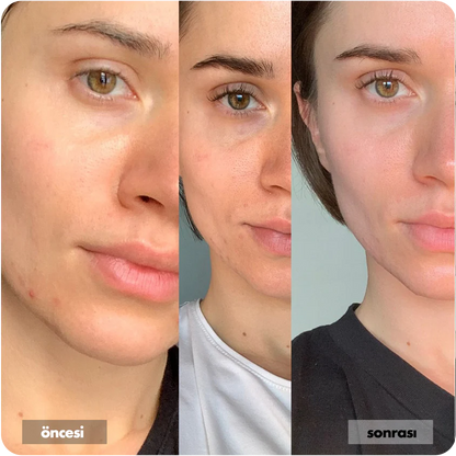 Nemlendirici Yüz Kremi Cilt Tonu Eşitleyici Aydınlatıcı 50 ML