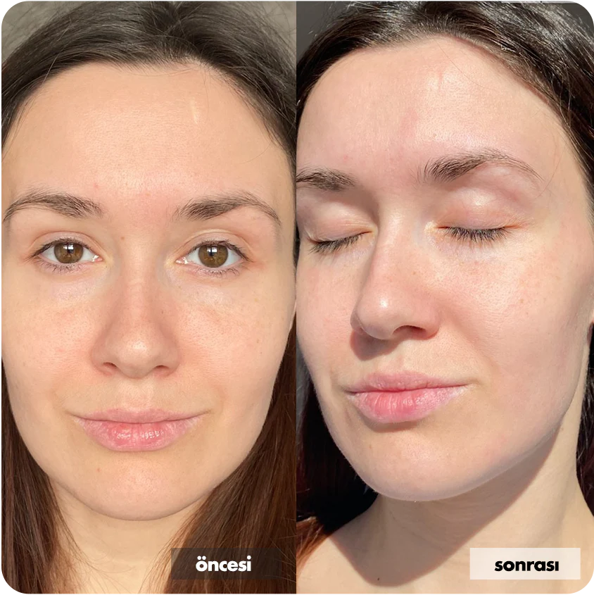 Hyaluronik Asit İçerikli Yüz Temizleme Jeli 400 ML