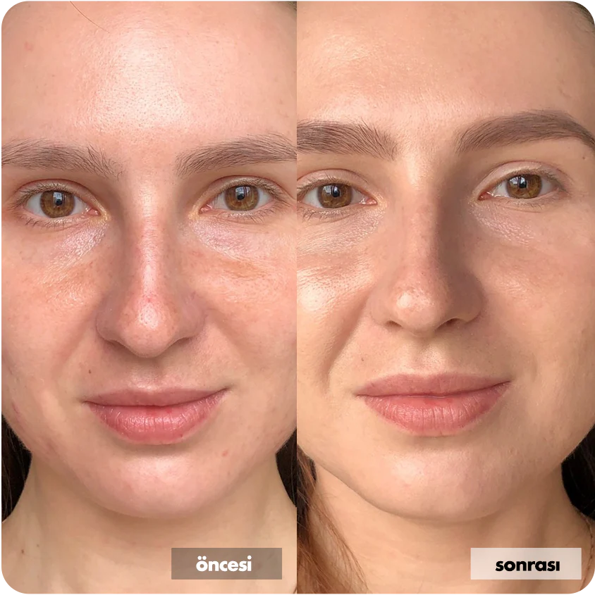 Hyaluronik Asit İçerikli Yüz Temizleme Jeli 400 ML