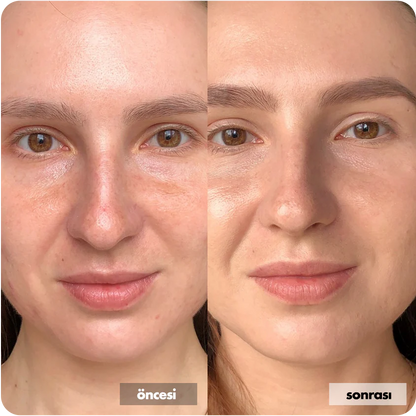 Hyaluronik Asit İçerikli Yüz Temizleme Jeli 400 ML