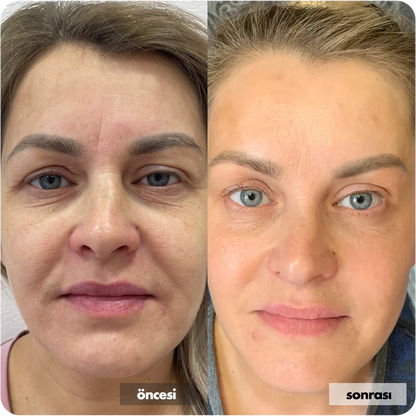 Hyaluronik Asit İçerikli Yüz Temizleme Jeli 400 ML